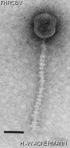 HER162 Image of phage under microscope