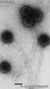 Image of phage under microscope