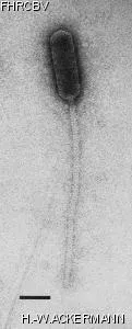 HER164 Image of phage under microscope