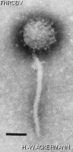 Image of phage under microscope