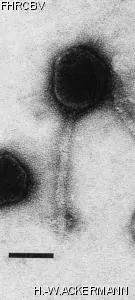 Image of phage under microscope