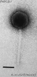 HER168 Image of phage under microscope