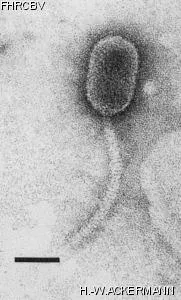 HER169 Image of phage under microscope