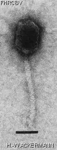 HER17 Image of phage under microscope