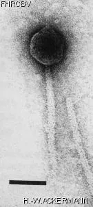 HER170 Image of phage under microscope