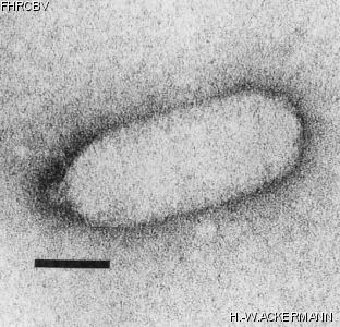 HER172 Image of phage under microscope