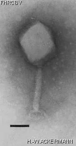 HER173 Image of phage under microscope