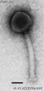 HER174 Image of phage under microscope