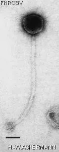 Image of phage under microscope