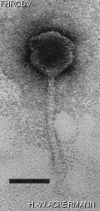 Image of phage under microscope