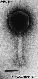 HER178 Image of phage under microscope