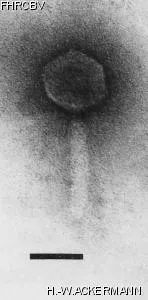 Image of phage under microscope