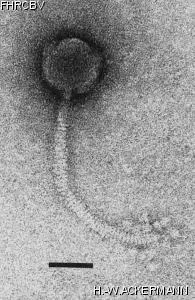 HER181 Image of phage under microscope
