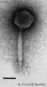 HER183 Image of phage under microscope