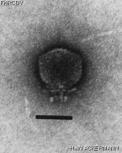 Image of phage under microscope