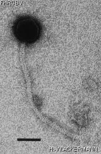 HER187 Image of phage under microscope