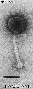 HER188 Image of phage under microscope