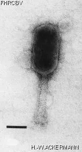 HER193 Image of phage under microscope