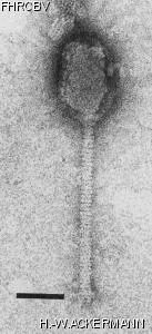 HER195 Image of phage under microscope