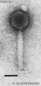 HER196 Image of phage under microscope
