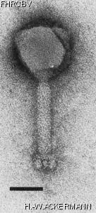 HER198 Image of phage under microscope
