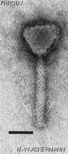 HER2 Image of phage under microscope