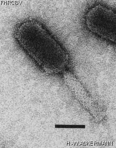 HER20 Image of phage under microscope