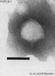 Image of phage under microscope