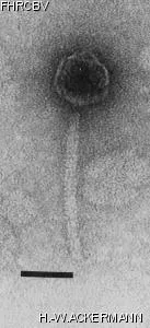HER203 Image of phage under microscope
