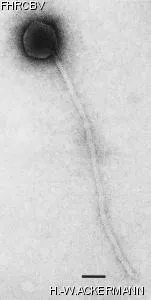 HER204 Image of phage under microscope