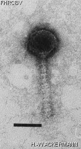 HER205 Image of phage under microscope