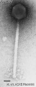HER206 Image of phage under microscope