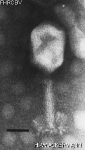 HER21 Image of phage under microscope