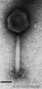 HER210 Image of phage under microscope
