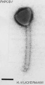 HER211 Image of phage under microscope