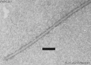 Image of phage under microscope