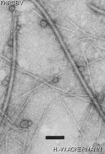 HER217 Image of phage under microscope
