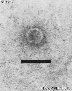 HER218 Image of phage under microscope