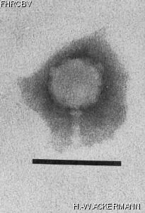 Image of phage under microscope