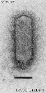 HER22 Image of phage under microscope