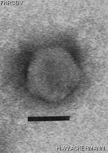 HER221 Image of phage under microscope