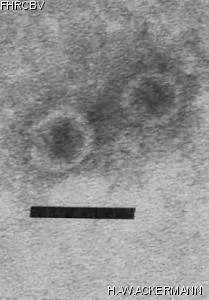 HER222 Image of phage under microscope