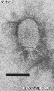 HER223 Image of phage under microscope
