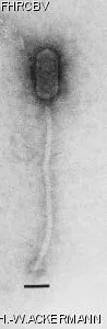 Image of phage under microscope