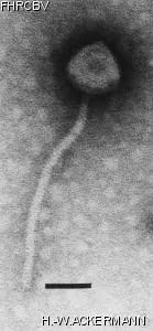 Image of phage under microscope