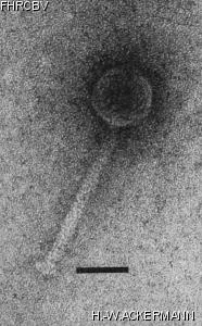 HER228 Image of phage under microscope