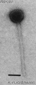 Image of phage under microscope