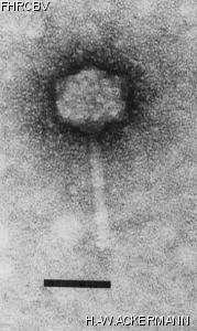 HER237 Image of phage under microscope