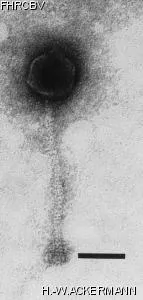 Image of phage under microscope