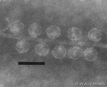 HER240 Image of phage under microscope